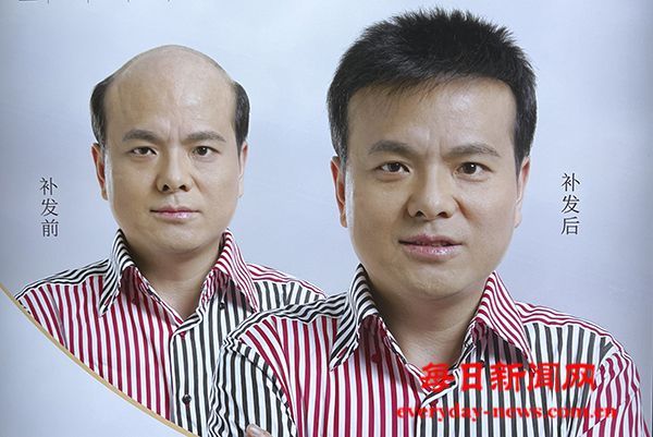 《唐风采假发增发北京分公司：为您的形象全